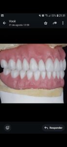 Prótese Dentária FA